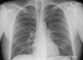 Ile czasu potrzeba aby oczyścić płuca?