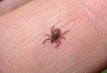 Co robi fryzjer gdy klient ma wszy?