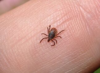 Co robi fryzjer gdy klient ma wszy?